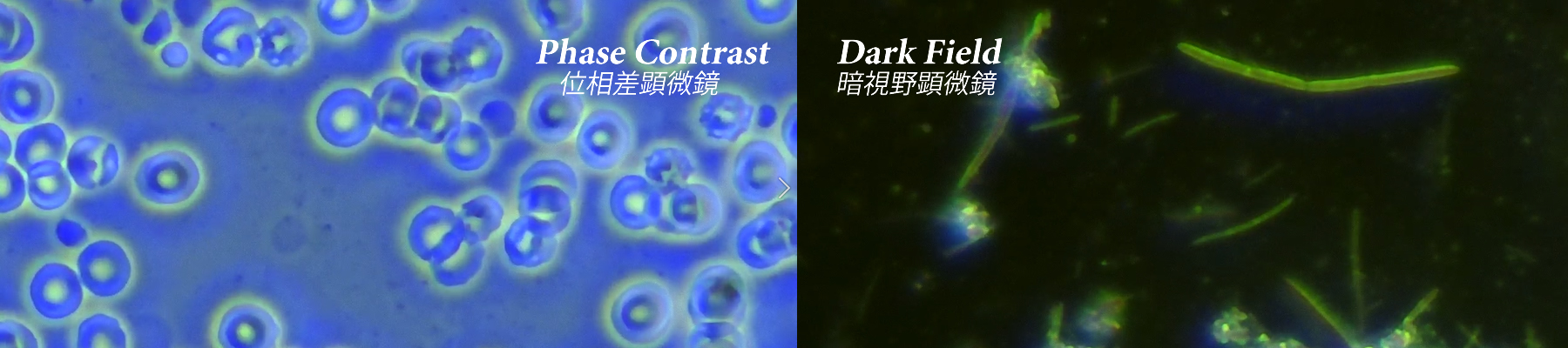 phasecontrast-darkfield(編集)